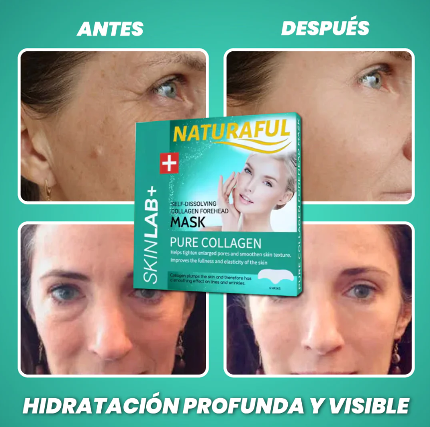 ¡Parches de Colágeno Autodisolventes! ✨💧 Rejuvenece y Nutre tu Piel 🔥 Oferta Exclusiva + Envío Gratis 🚚 ¡Luce un Rostro Radiante al Instante!