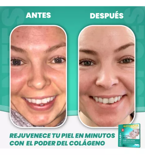 ¡Parches de Colágeno Autodisolventes! ✨💧 Rejuvenece y Nutre tu Piel 🔥 Oferta Exclusiva + Envío Gratis 🚚 ¡Luce un Rostro Radiante al Instante!