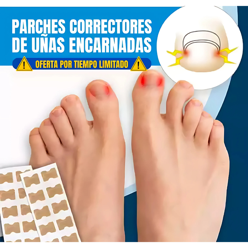 ¡Parches Correctores de Uñas! 💅✨ Solución Fácil y Efectiva para Uñas Perfectas 🔥 Cuida tu Belleza 🚚 ¡Llévatelos con Envío Gratis!